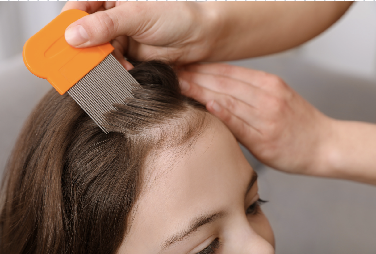 Is Spotting Lice Harder Based on Hair Color? Evansville Lice Clinic